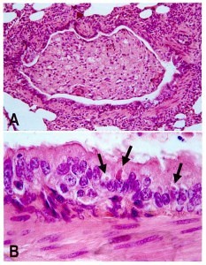 Staupe Virus